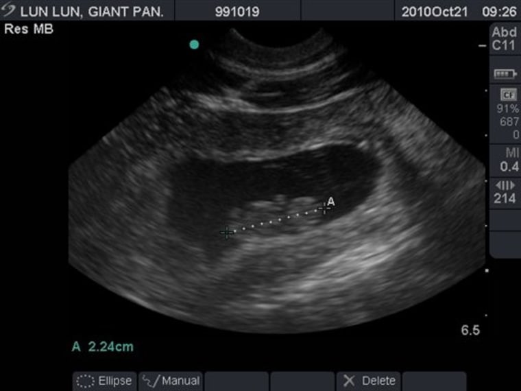 This undated photo provided by Zoo Atlanta shows the ultrasound confirming the pregnancy of Giant panda Lun Lun. Zoo Atlanta said Friday, Oct. 22, 2010 that they have confirmed the pregnancy with an ultrasound of mother Lun Lun. This will be the third cub for the 13-year-old panda. The Animal Management and Veterinary Teams estimate that a birth should occur in 10 days to 2 weeks. While cautiously optimistic, experts caution that Lun Lun could still miscarry or reabsorb the fetus as her pregnancy progresses. (AP Photo/Zoo Atlanta)